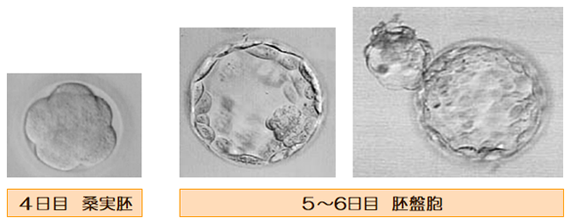 胚の発育2