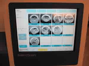 1. Embryoscope