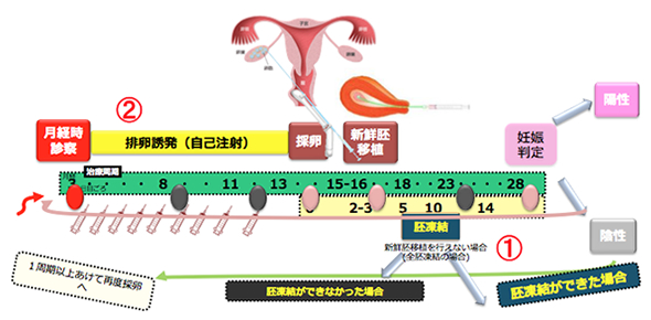 対外受精・新鮮胚移植の流れ（例）